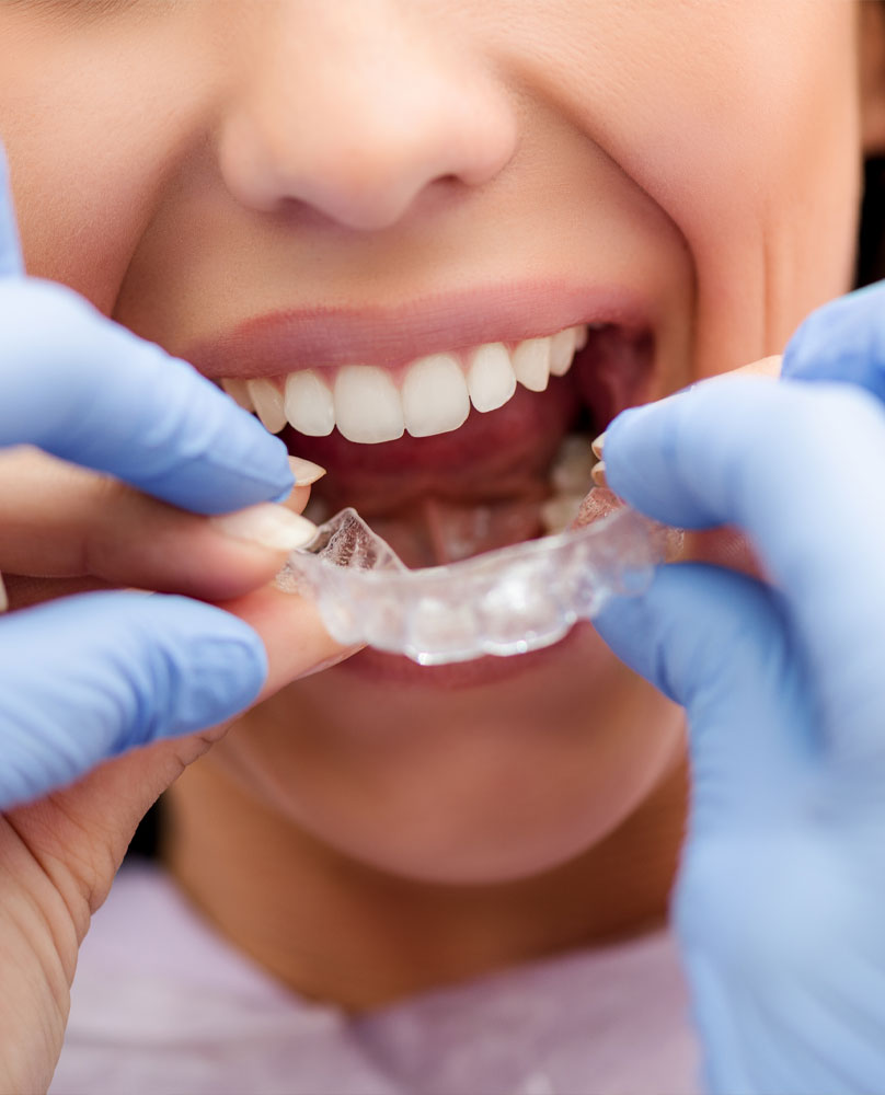 OrthodonticsInvisibleBraces-CudahyDental